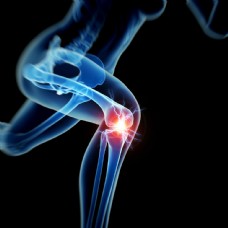 图片素材人体膝关节疼痛图片